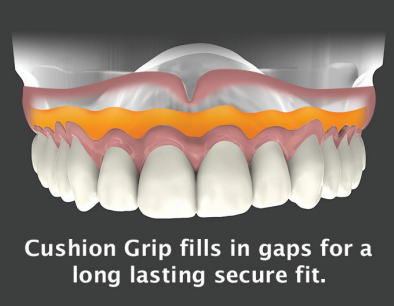 showing the importance of a denture reline. Cushion Grip fills in gaps for a long lasting secure fit. 